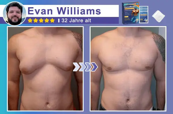 Gynecomastia Breast Fat Burning & Firming Patch - Image 6