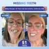 🦷 Tideglusib Fast‑Dissolving Tooth & Gum Repair Oral Strips ✨