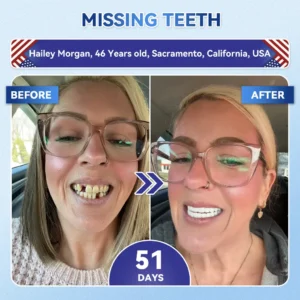🦷 Tideglusib Fast‑Dissolving Tooth & Gum Repair Oral Strips ✨
