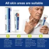Targeted Skin Tag & Wart Removal Cream – Time-Released Phyto-Exfoliant (12% Celandine ) & Bio-Active Terpene Viral-Inhibitor (8% Thuja)