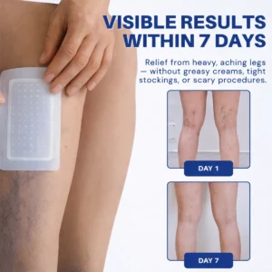 Vein Contour Microneedle Patch with Advanced Diosmin & Hesperidin Delivery🌿 — 7-Day Visible Results for Varicose Veins