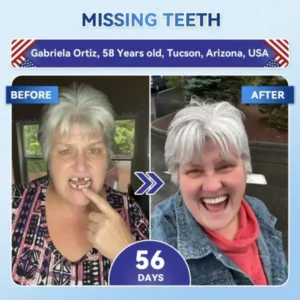Your Smile~ 🦷 Tideglusib Fast‑Dissolving Tooth & Gum Repair Oral Strips ✨ (𝟓-𝐢𝐧-𝟏 💎 𝐑𝐞𝐛𝐮𝐢𝐥𝐝 𝐄𝐧𝐚𝐦𝐞𝐥 & 𝐃𝐞𝐧𝐭𝐢𝐧 • 𝐒𝐭𝐫𝐞𝐧𝐠𝐭𝐡𝐞𝐧 𝐆𝐮𝐦𝐬 • 𝐄𝐫𝐚𝐝𝐢𝐜𝐚𝐭𝐞 𝐓𝐚𝐫𝐭𝐚𝐫 & 𝐎𝐝𝐨𝐫 • 𝐖𝐡𝐢𝐭𝐞𝐧𝐢𝐧𝐠 • 𝐒𝐭𝐨𝐩 𝐓𝐨𝐨𝐭𝐡 𝐒𝐞𝐧𝐬𝐢𝐭𝐢𝐯𝐢𝐭𝐲)