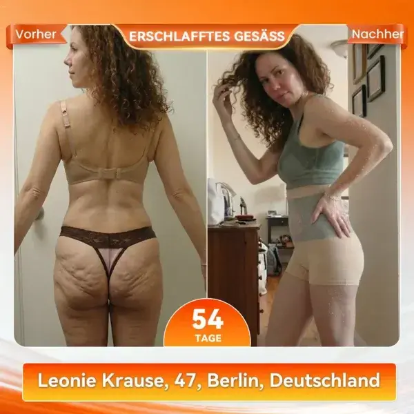 2026 NEUE VERSION 𝐌𝒐𝗋𝐢𝐧𝐠𝒂 & 𝐁𝗲𝗋𝐛𝐞𝐫𝐢𝐧𝐞 4-in-1 Mikropartikel-Shaping & Fettverbrennungs-Shortss - Image 10