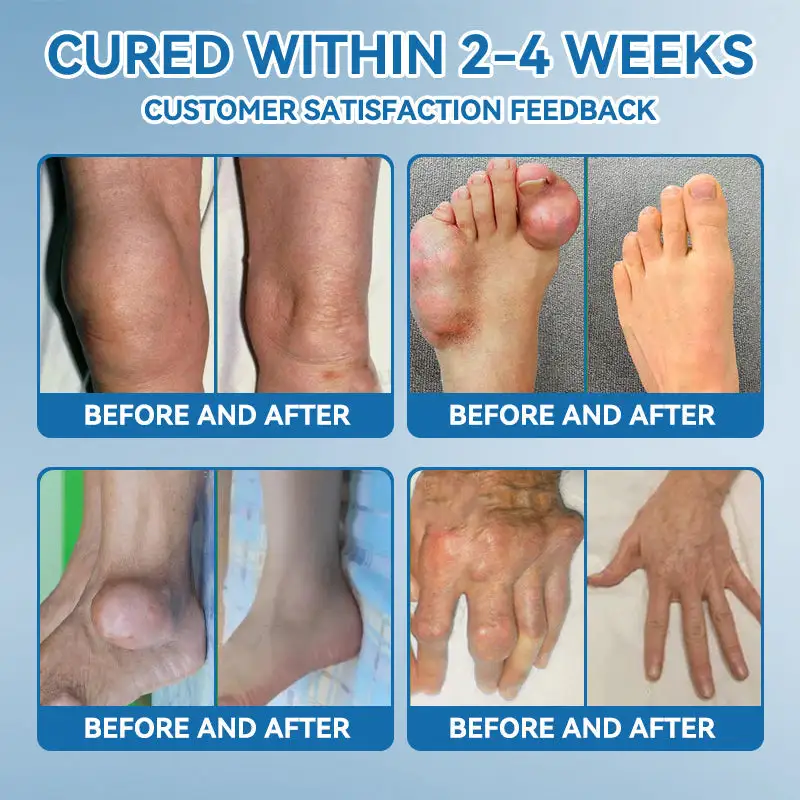 BPC-157 Joint Healing Cream - Image 11