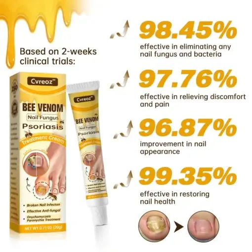 Bee Venom Nail Fungus Psoriasis Treatment Cream - Image 2