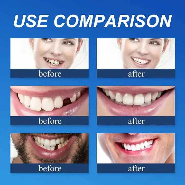 🦷Custom-Fit Dentures | Smile with Confidence - Image 6