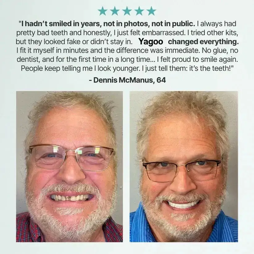 ⏰Ends Today: 70% OFF! Custom-Fit Dentures— Designed for Comfort and a Natural-Looking Smile - Image 20