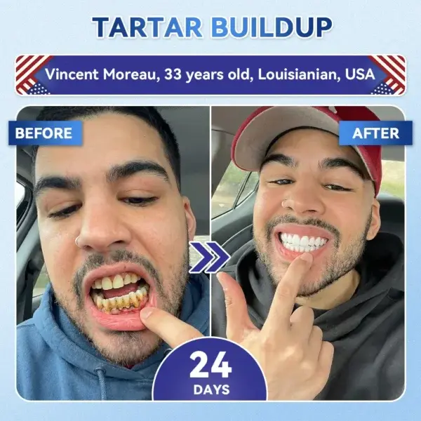 Tooth & Gum Repair - Image 5