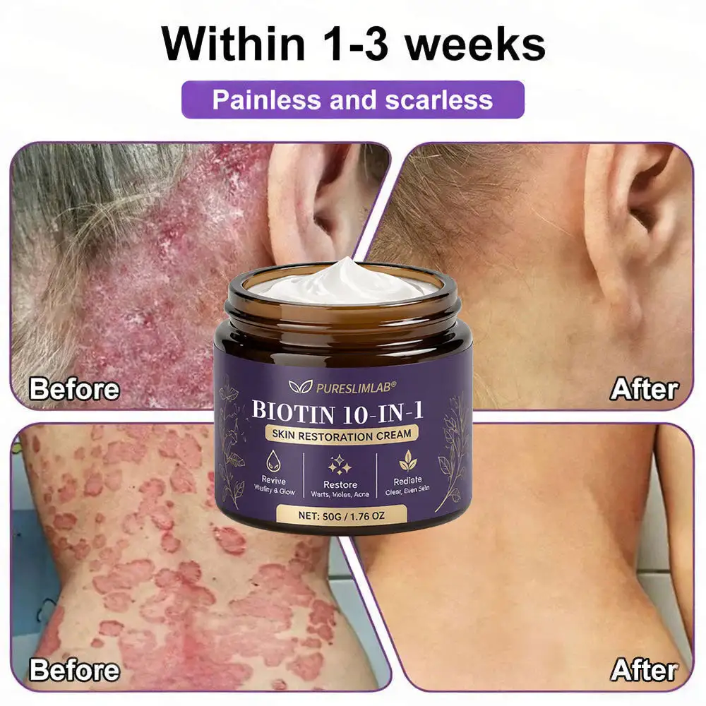 Biotin Cream 2026 | Skin Repair Formula - Image 3