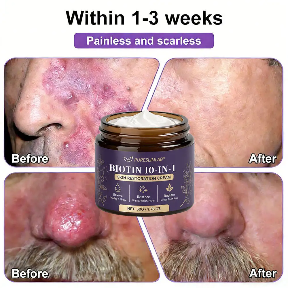 Biotin Cream 2026 | Skin Repair Formula - Image 7