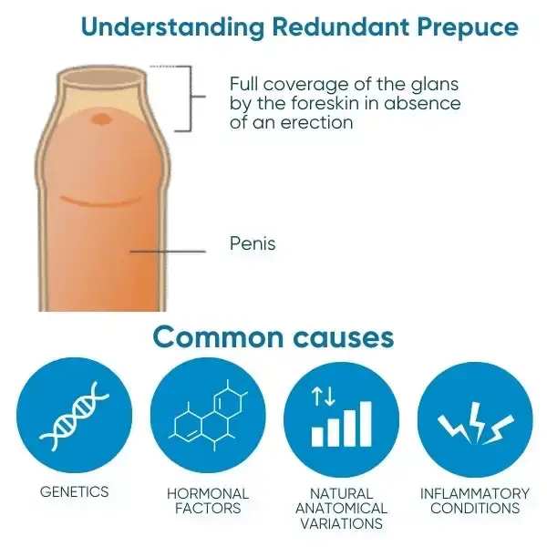 Redundant Prepuce Corrector Gel - Image 2