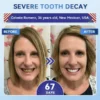 🦷 Tideglusib Fast‑Dissolving Tooth & Gum Repair Oral Strips 😁 (Supports tooth repair and helps relieve gum discomfort and other common oral concerns)