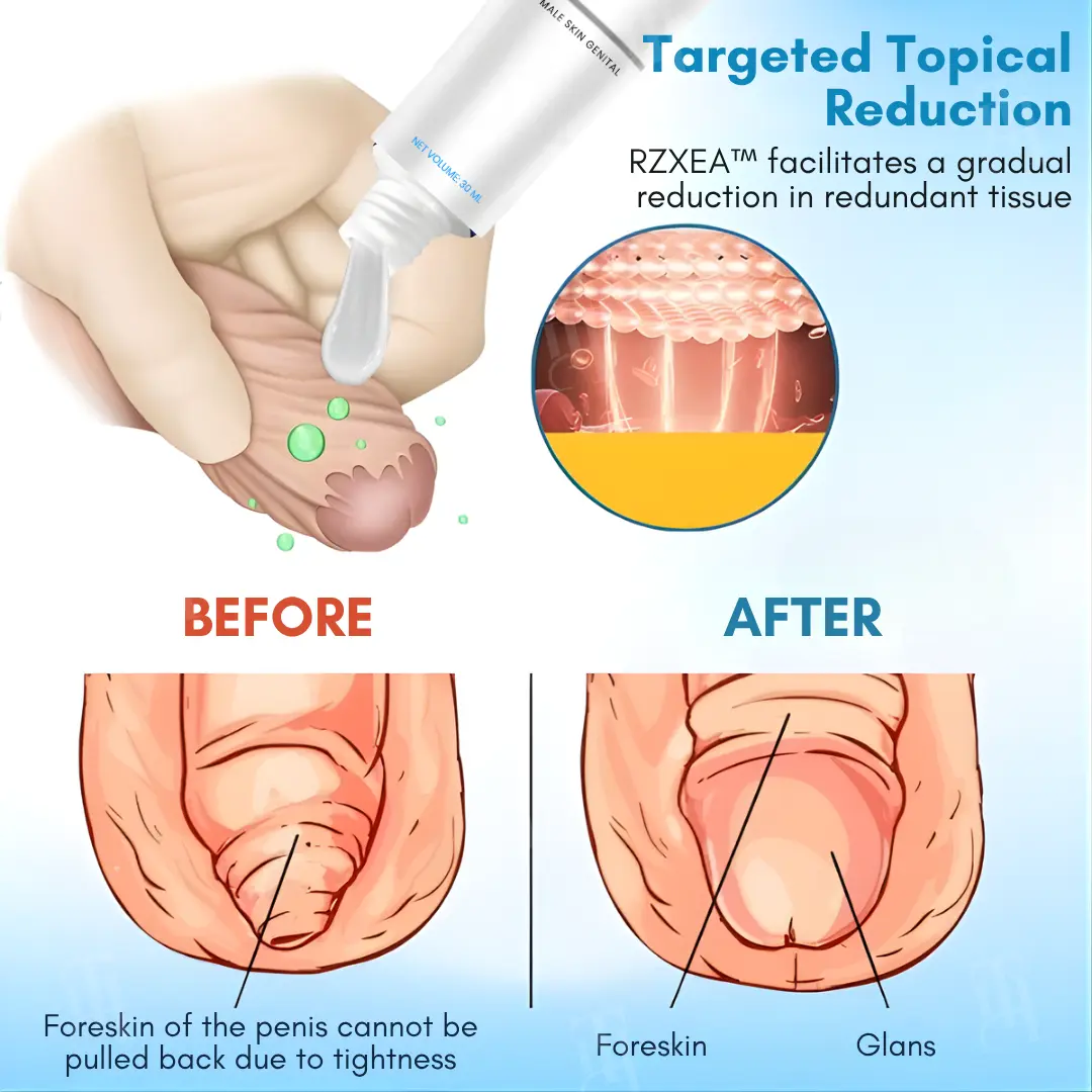 Foreskin Elasticity Gel 2026 | Non-Surgical Relief - Image 3