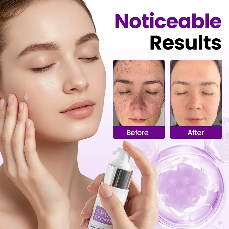 SpotRefiner Probiotic Shield Serum - Image 3