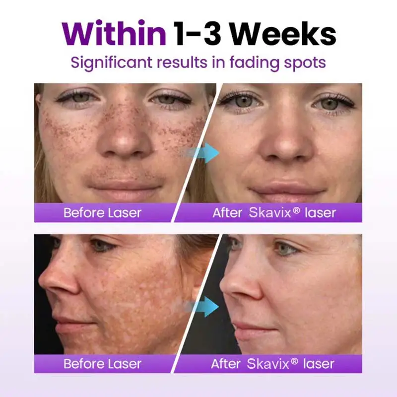 SpotRefiner Probiotic Shield Serum - Image 4