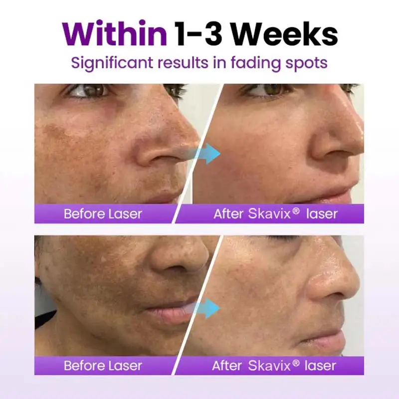 SpotRefiner Probiotic Shield Serum - Image 7