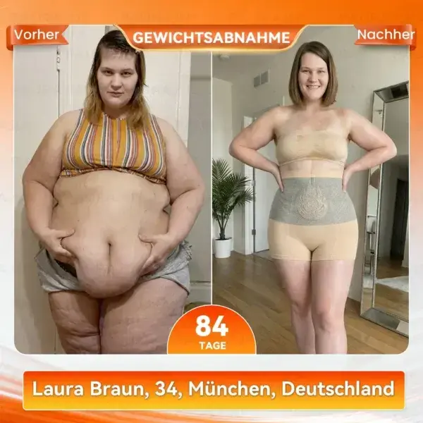 2026 NEUE VERSION 𝐌𝒐𝗋𝐢𝐧𝐠𝒂 & 𝐁𝗲𝗋𝐛𝐞𝐫𝐢𝐧𝐞 4-in-1 Mikropartikel-Shaping & Fettverbrennungs-Shortss - Image 17