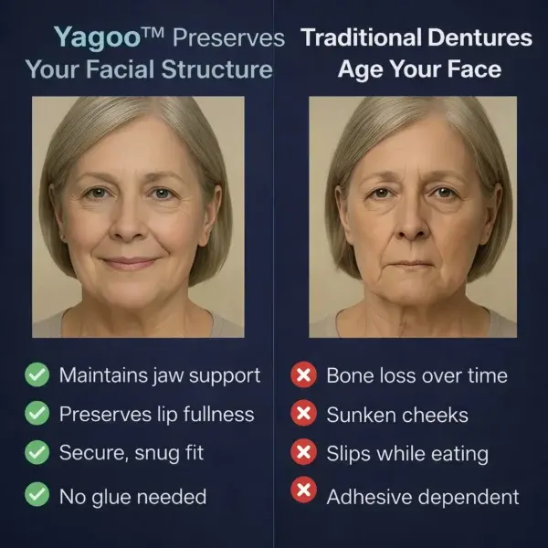 2026🏆✨LAST DAY SALE 60% OFF🔥 Newly upgraded second-generation complete dentures - Image 7