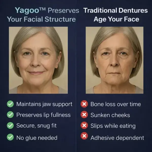 2026🏆✨LAST DAY SALE 60% OFF🔥 Newly upgraded second-generation complete dentures - Image 7