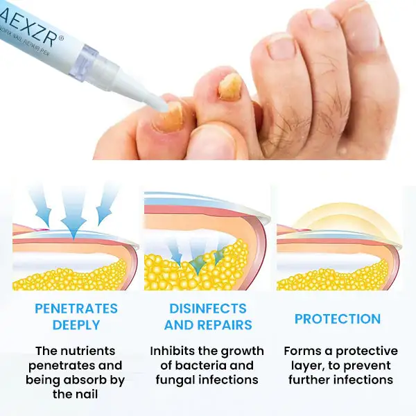 NanoFix Nail Repair Pen 2026 | Healthy Nail Support - Image 5