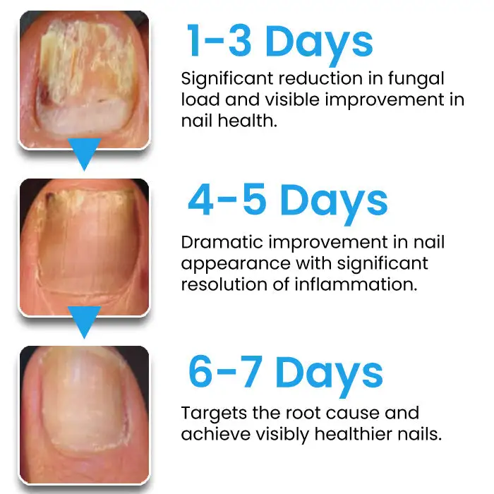 NanoFix Nail Repair Pen 2026 | Healthy Nail Support - Image 6