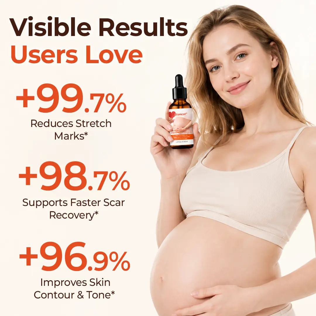 SilkStretch Natural Stretch Mark & Scar Oil - Image 7