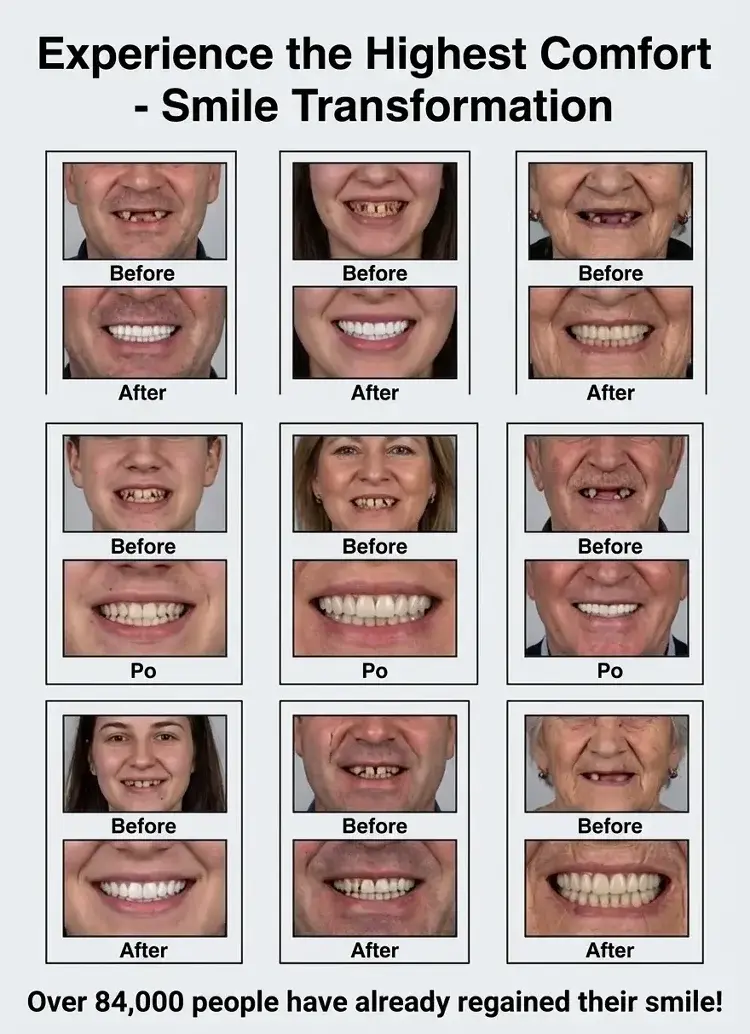🏆Ends Today: 70% OFF! 🏆2026 Bestselling Product🦷 Fit for a Fresh Smile, Say Goodbye to Wearing Discomfort! - Image 3