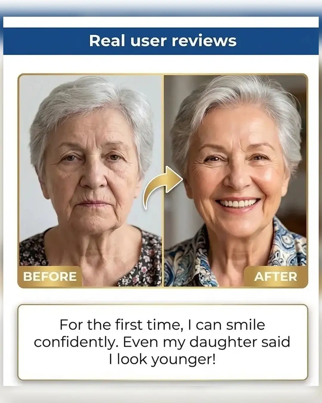 🏆Ends Today: 70% OFF! 🏆2026 Bestselling Product🦷 Fit for a Fresh Smile, Say Goodbye to Wearing Discomfort! - Image 5