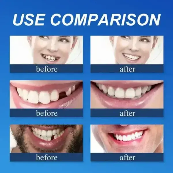 🏆Ends Today: 70% OFF! 🏆2026 Bestselling Product🦷 Fit for a Fresh Smile, Say Goodbye to Wearing Discomfort!🌎 - Image 10