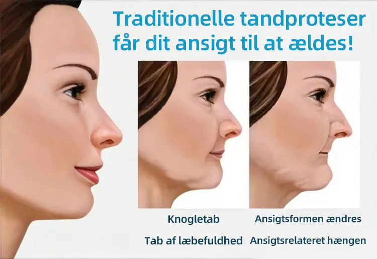 Fuldt tandproteser Sæt 🦷🦷💃Avancerede selvjusterende tandlæge Materialer (⏰Begrænset tidsrabat sidste 30 minutter⏰) - Image 11