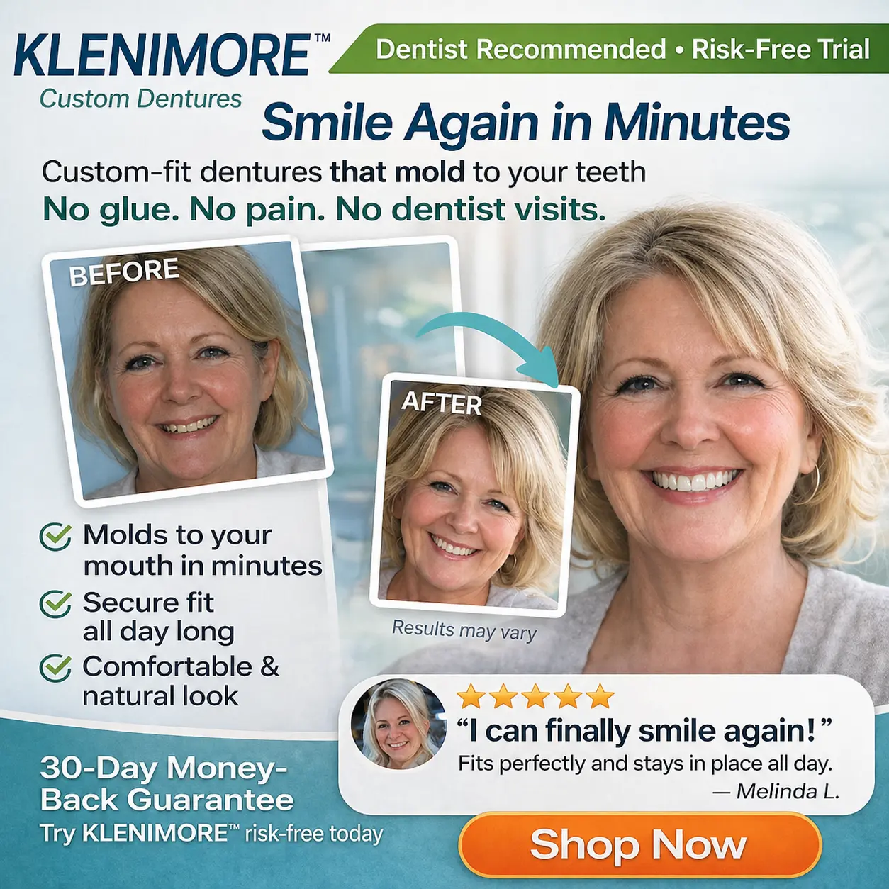 Complete Dentures 2026 | Natural Fit Smile - Image 6