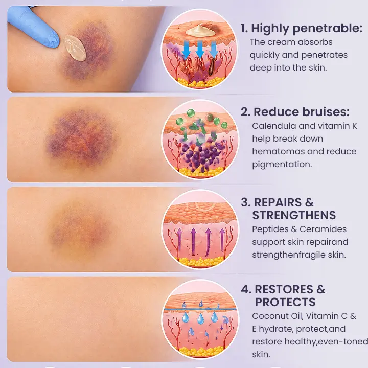 Bruise Repair & Skin-Strengthening Cream - Image 11