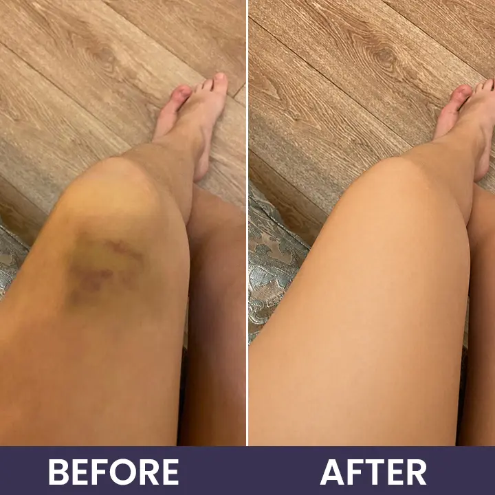 Bruise Repair & Skin-Strengthening Cream - Image 13