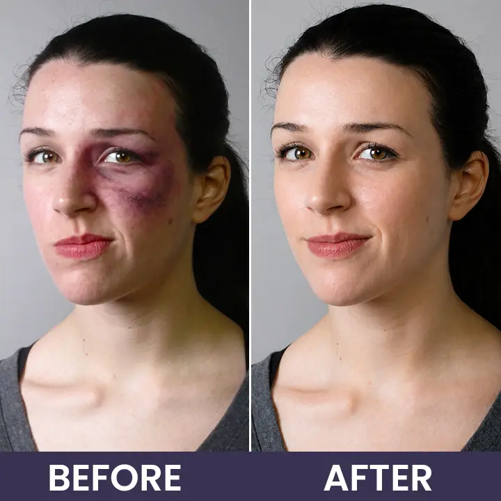 Bruise Repair & Skin-Strengthening Cream - Image 14