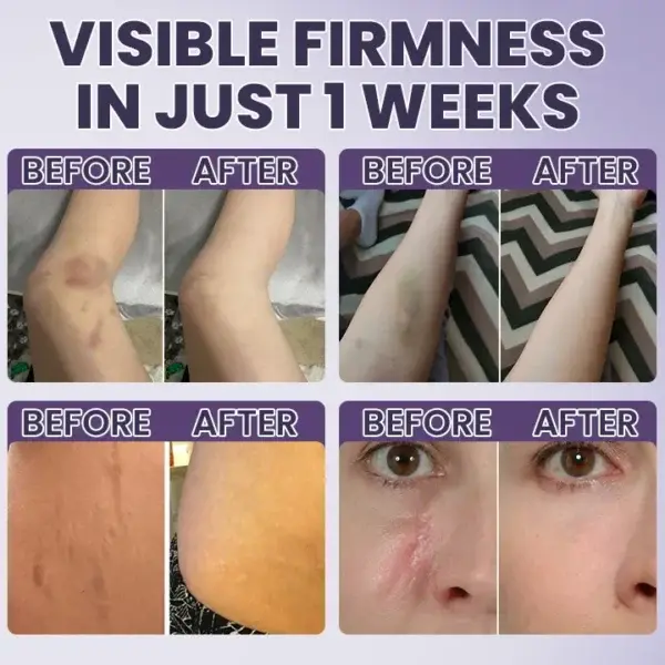 Bruise Repair & Skin-Strengthening Cream - Image 11