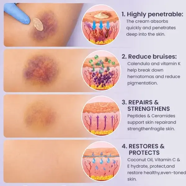 Bruise Repair & Skin-Strengthening Cream - Image 12