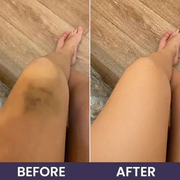Bruise Repair & Skin-Strengthening Cream - Image 14
