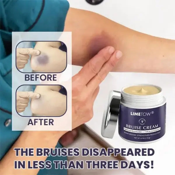 Bruise Repair & Skin-Strengthening Cream - Image 6