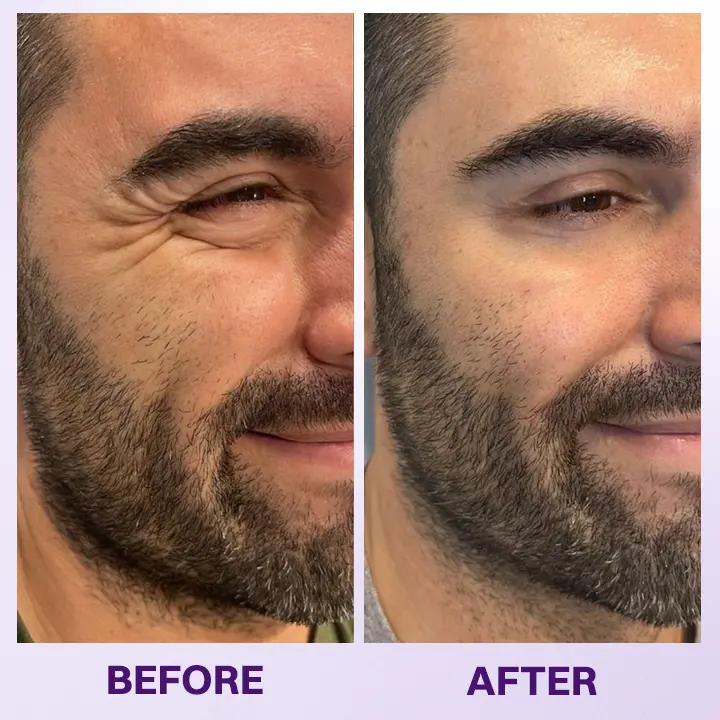 Instant Lift Eye Gel - Image 11