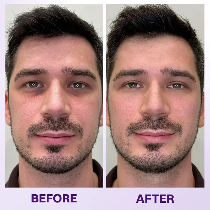 Instant Lift Eye Gel - Image 13