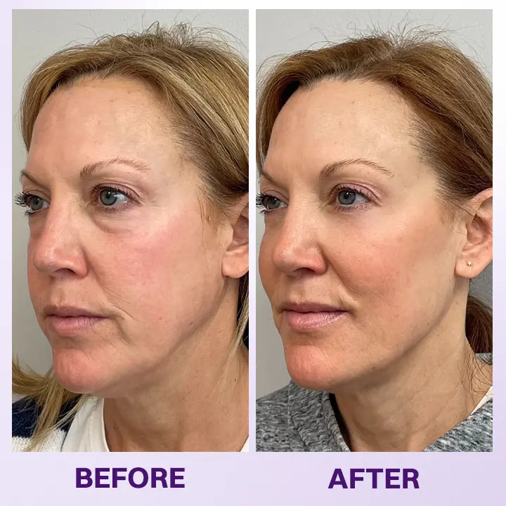 Instant Lift Eye Gel - Image 15