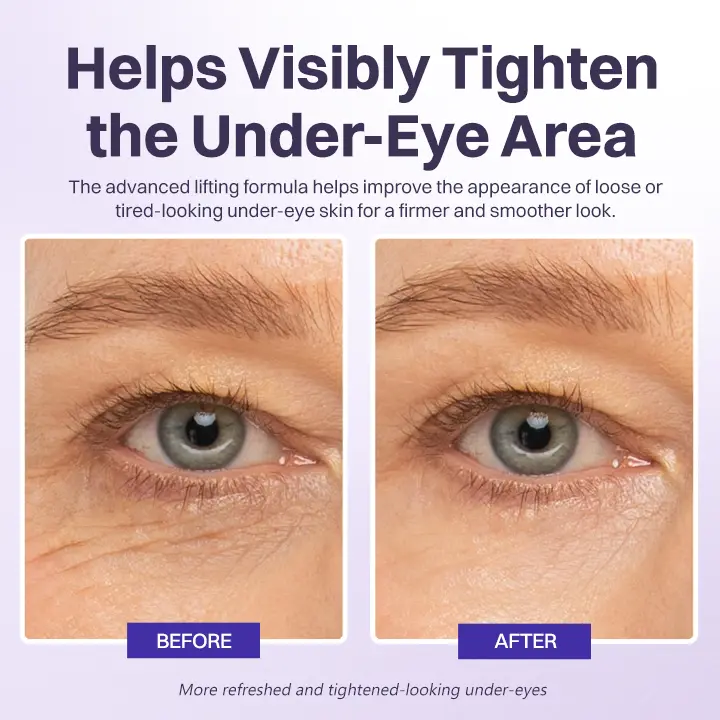 Instant Lift Eye Gel - Image 9