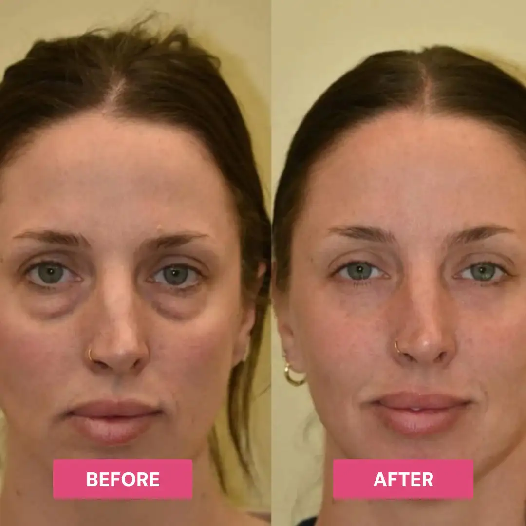 Korean PDRN Pink Collagen Volume Balm - Image 4