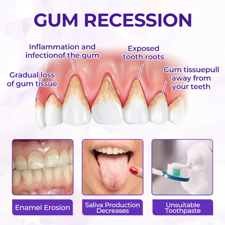 Fluoride Toothpaste - Image 10