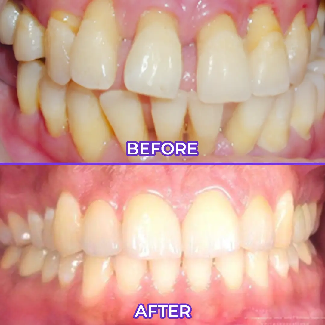 Fluoride Toothpaste - Image 3