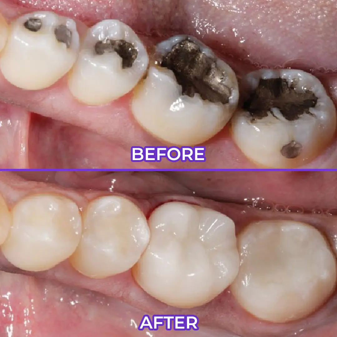Fluoride Toothpaste - Image 5