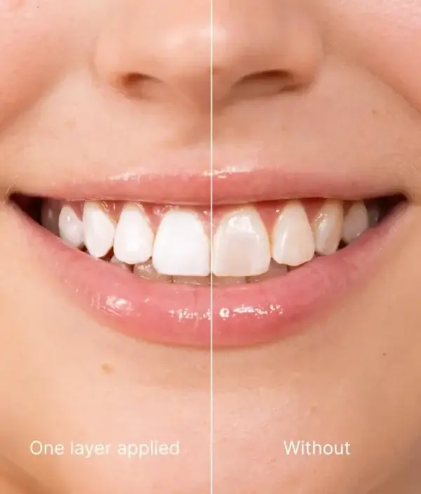 Skavix Tooth Polish | Instant White Smile - Image 4