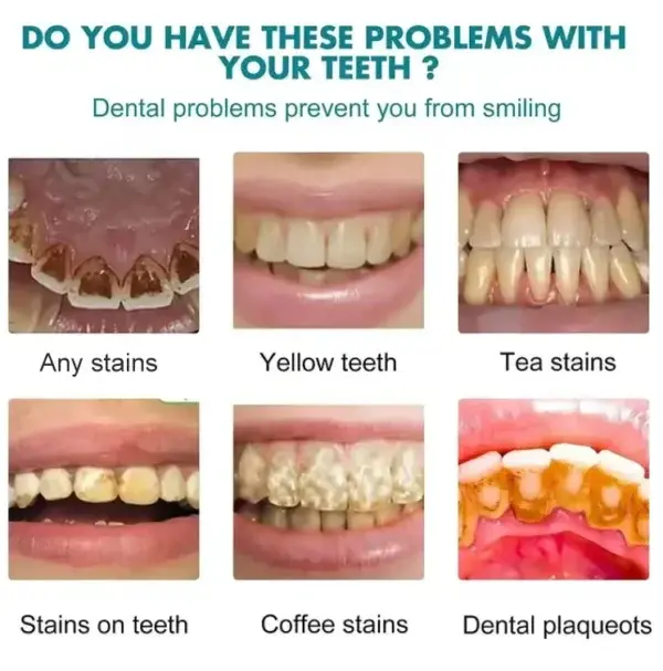 Skavix Tooth Polish | Instant White Smile - Image 6