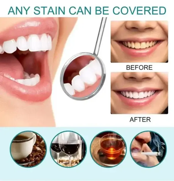 Skavix Tooth Polish | Instant White Smile - Image 7