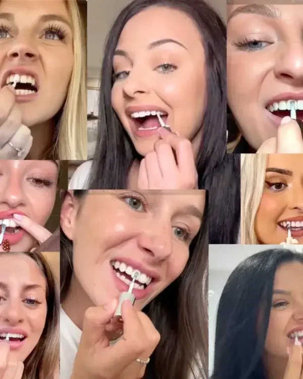 Skavix Tooth Polish | Instant White Smile - Image 8